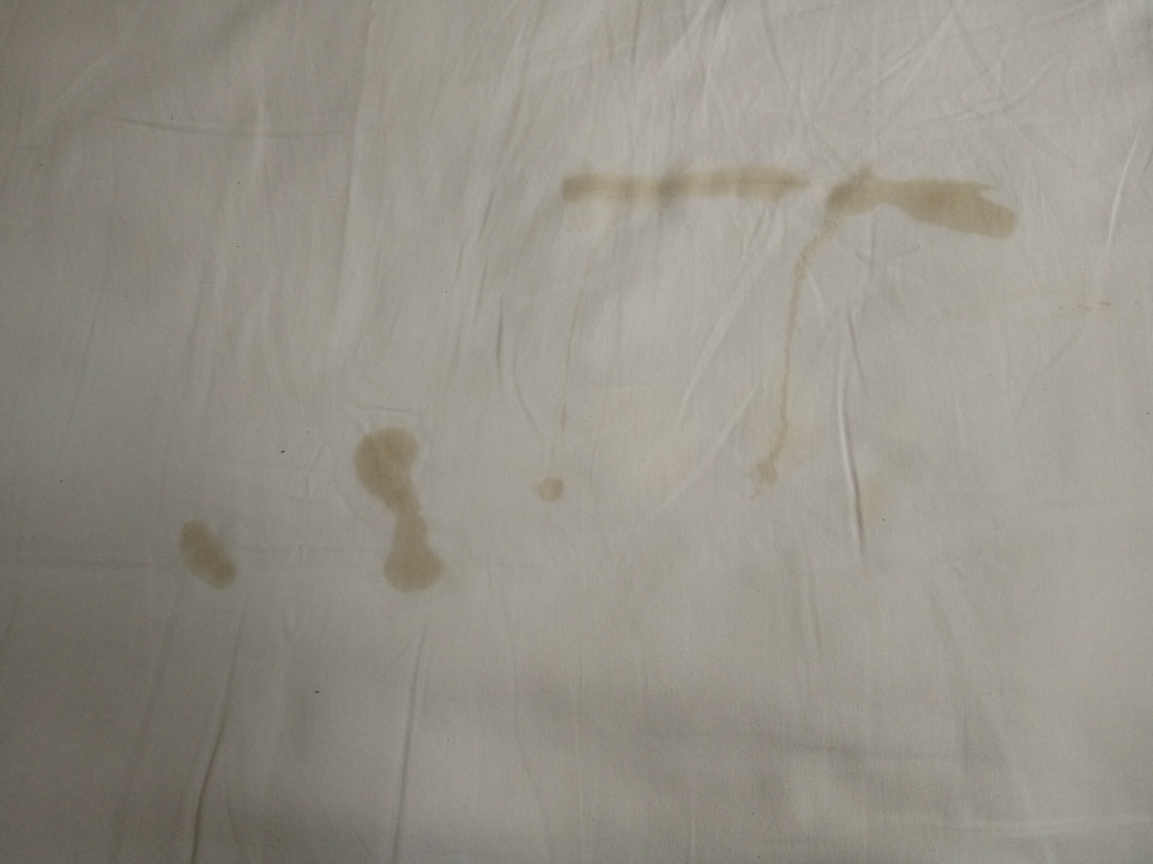 今早上起床后,床单上有这样式的.是不是破水?