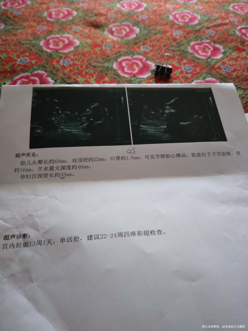 昨天nt大家帮我猜猜是男宝还是女宝