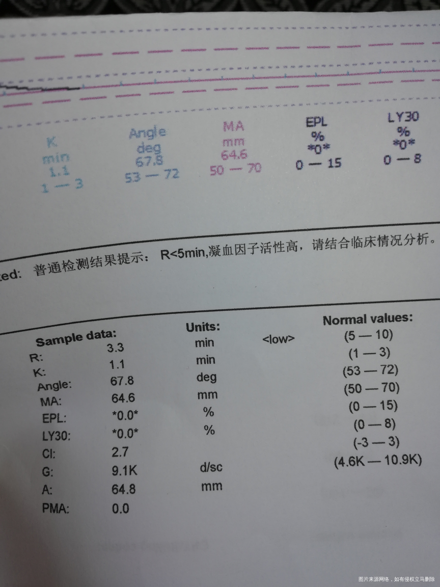 你好大夫,我现在孕13周去医院检查血栓弹