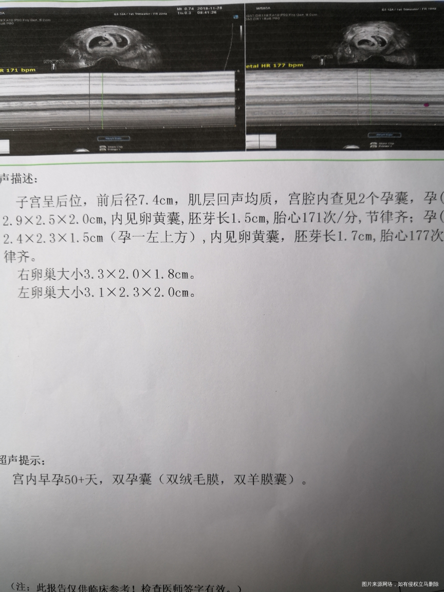 请帮忙看看,这个是否正常,第二次移植