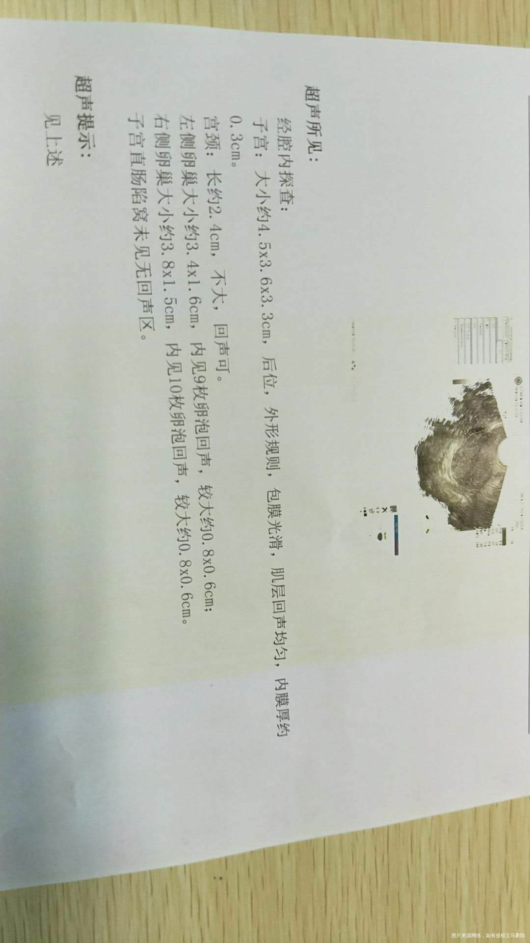 医生看看我这个怎么情况??现在要怎么办