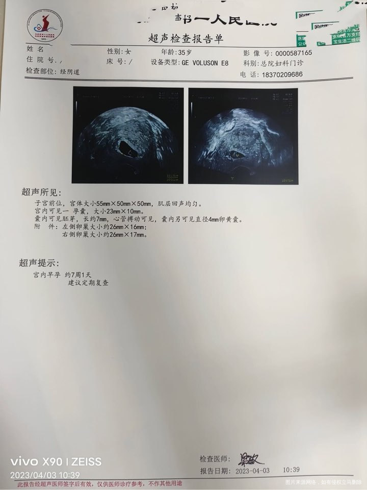 之前做了公立好多一代二代都失败了,后来千挑万选找了个私立,结果一次就成功了