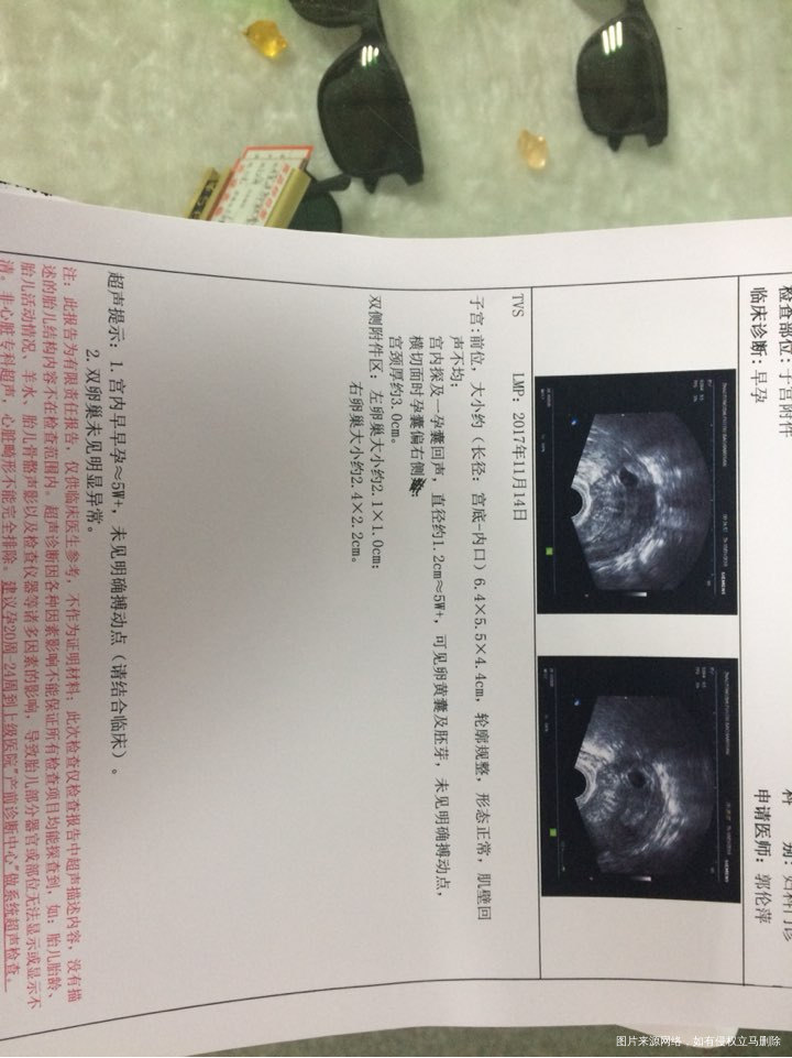 医生帮忙看看刚刚出来的BC单