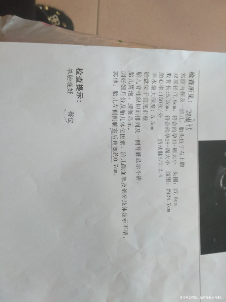 医生帮忙看看B超单,医生说胎儿左侧侧脑室后角