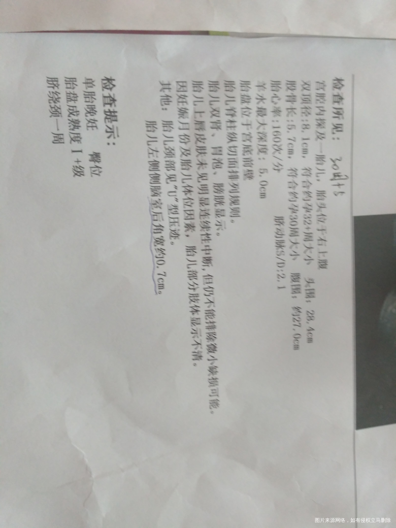 医生帮忙看看B超单,医生说胎儿左侧侧脑室后角