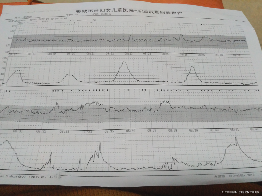 35+4周做胎心监护,说是宫缩厉害,