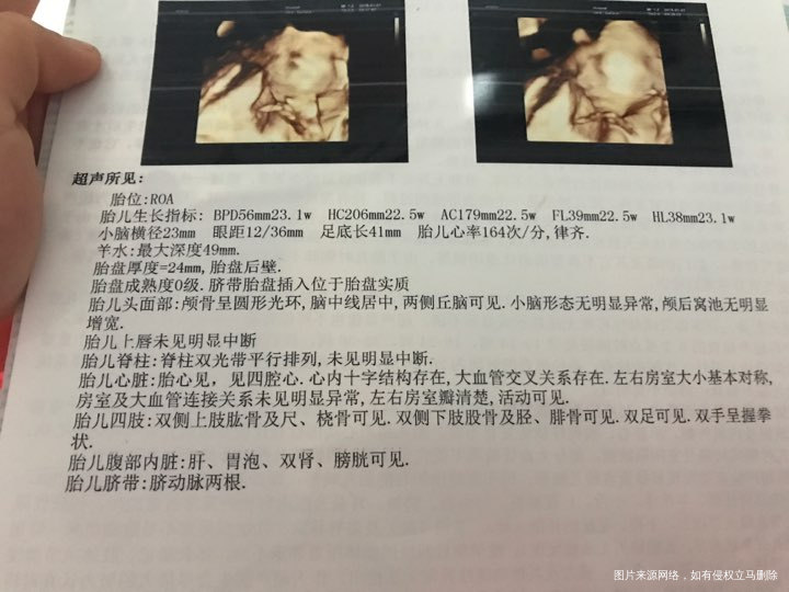 医生帮忙看看宝宝健康吗?