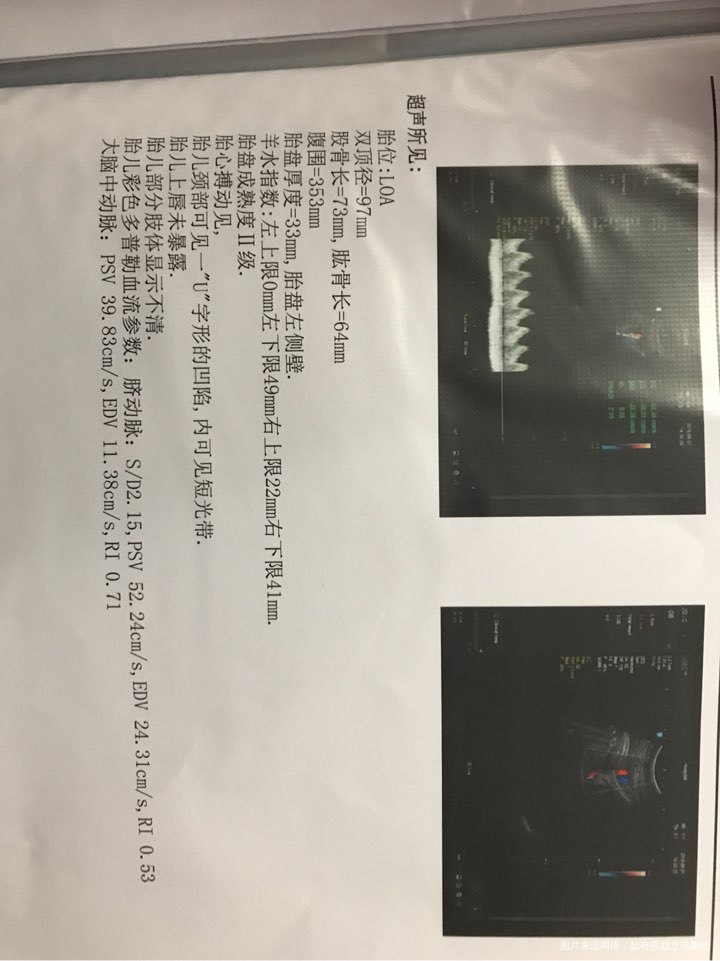 孕40周,请医生帮我看下宝宝大概多重