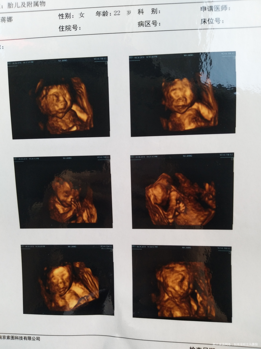 姐妹们进来帮忙看一下