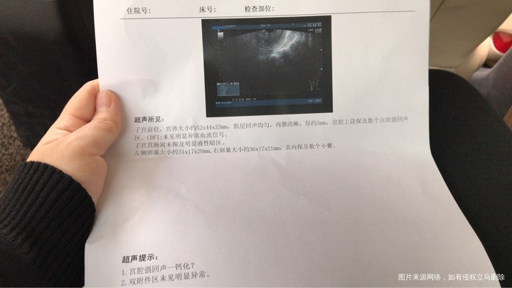 产后39天阴超报告,麻烦看看怎么样