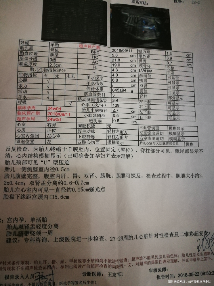 麻烦医生帮忙看看四维结果