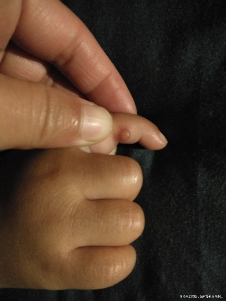 有姐妹们知道这种情况的吗