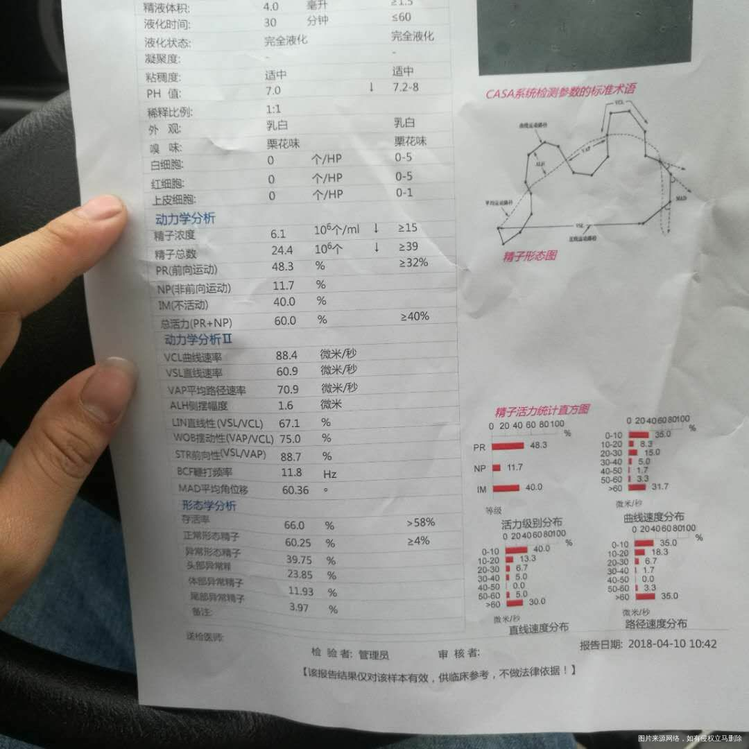 备孕一年了没避孕一直未孕