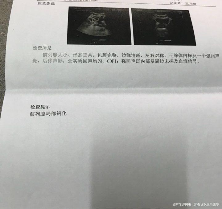 两次胎停一次生化,这是我老公单子,麻烦医生看下