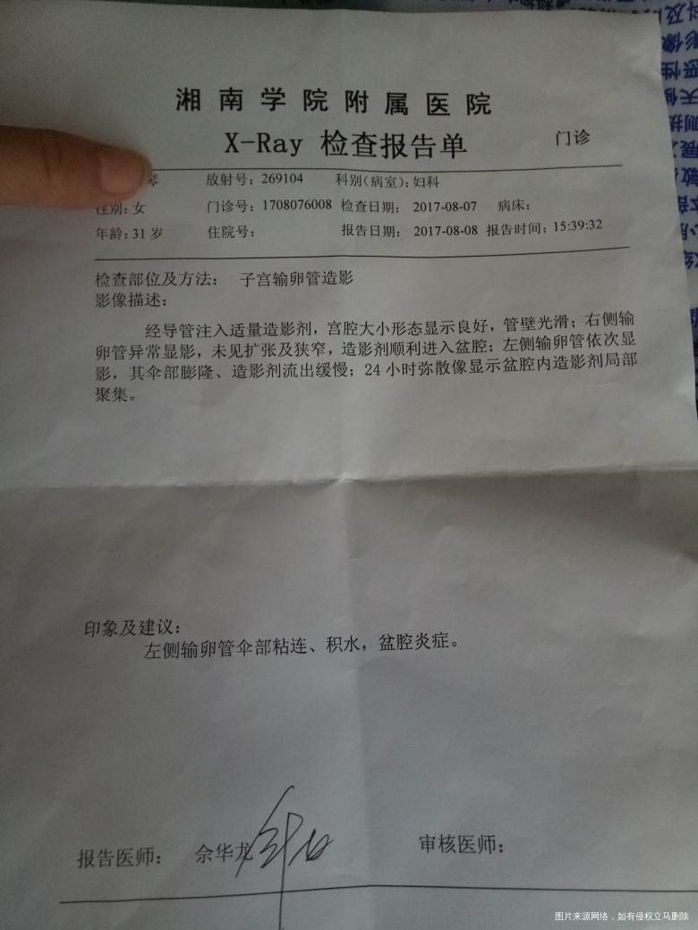 输卵管左边伞部粘连,右边好,左边排卵可以要孩子吗