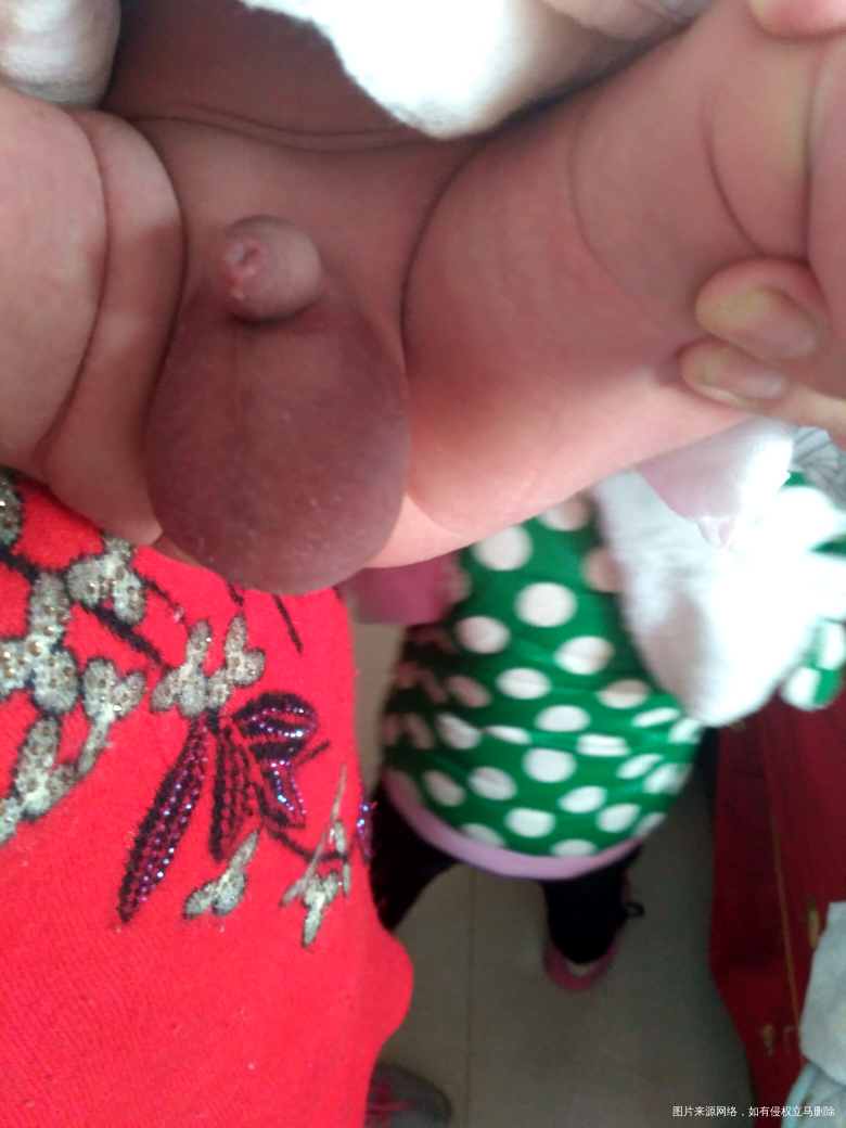 求助医生帮我看看正常吗?谢谢医生