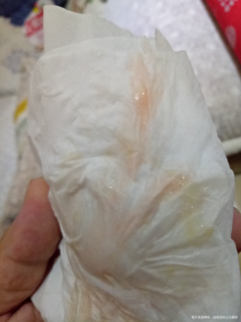 医生这种情况是见红吗,,用不用去医院