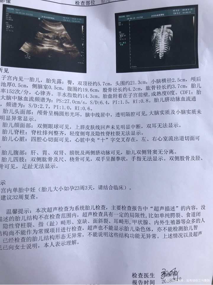 各位亲们快来帮忙看啦,男孩女孩?