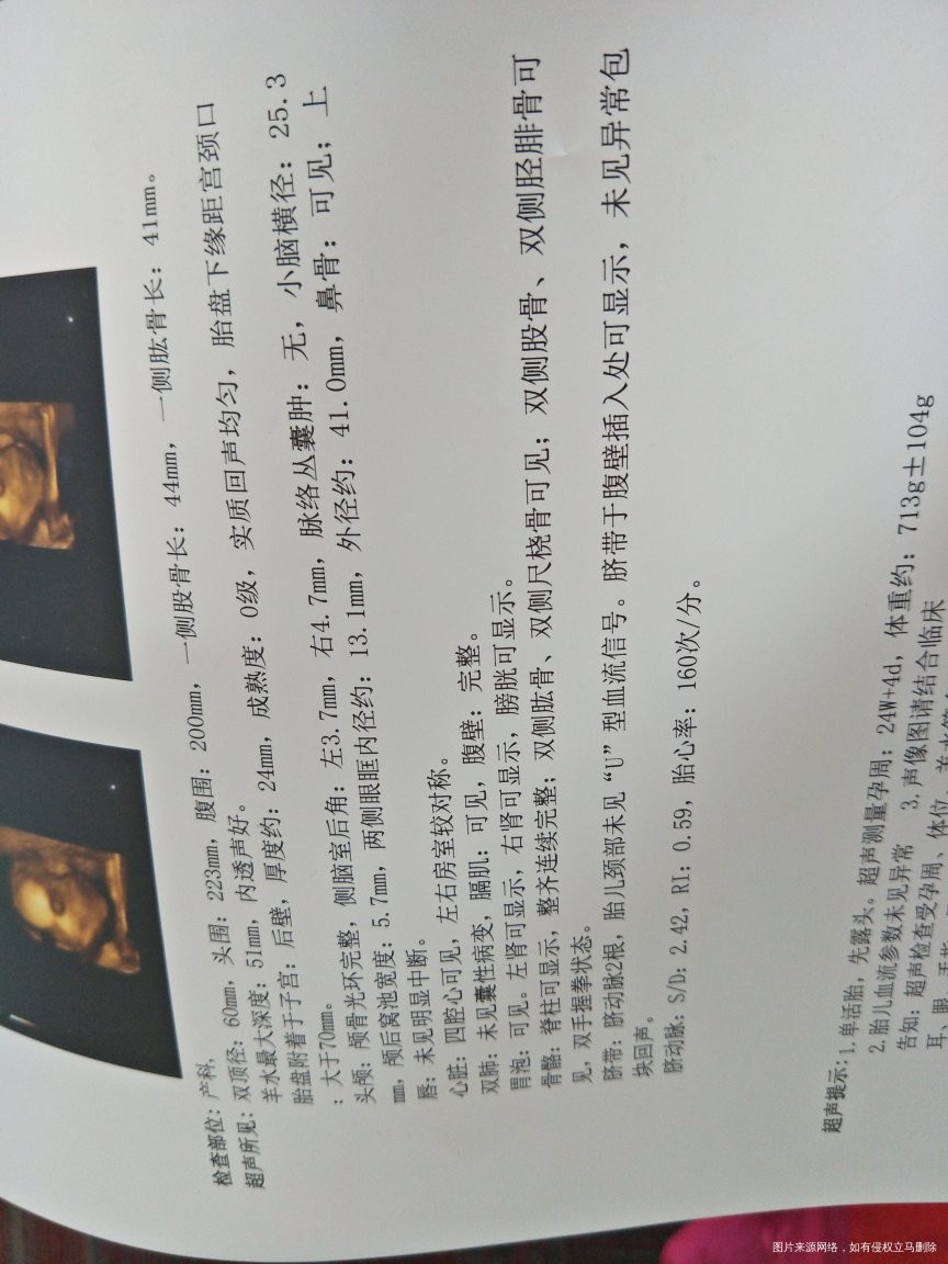 姐妹们帮我看看男孩女孩呀?