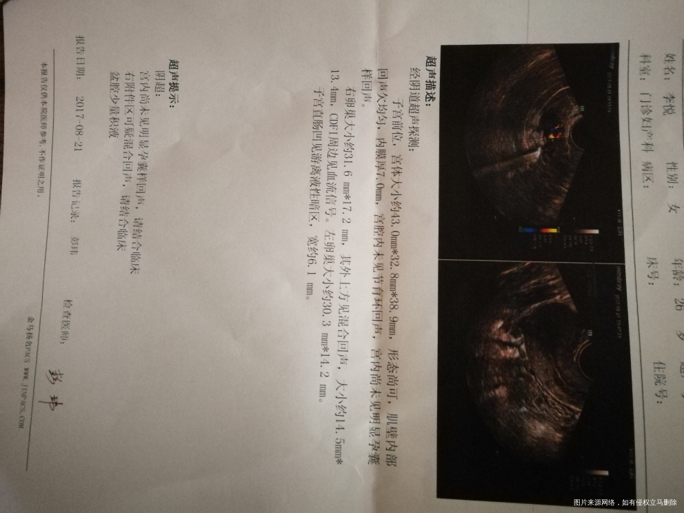 急急急,医生帮忙看一下这个是宫外孕吗