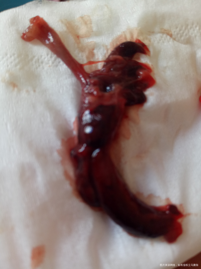 促排阶段.22号早上掉了一坨血块