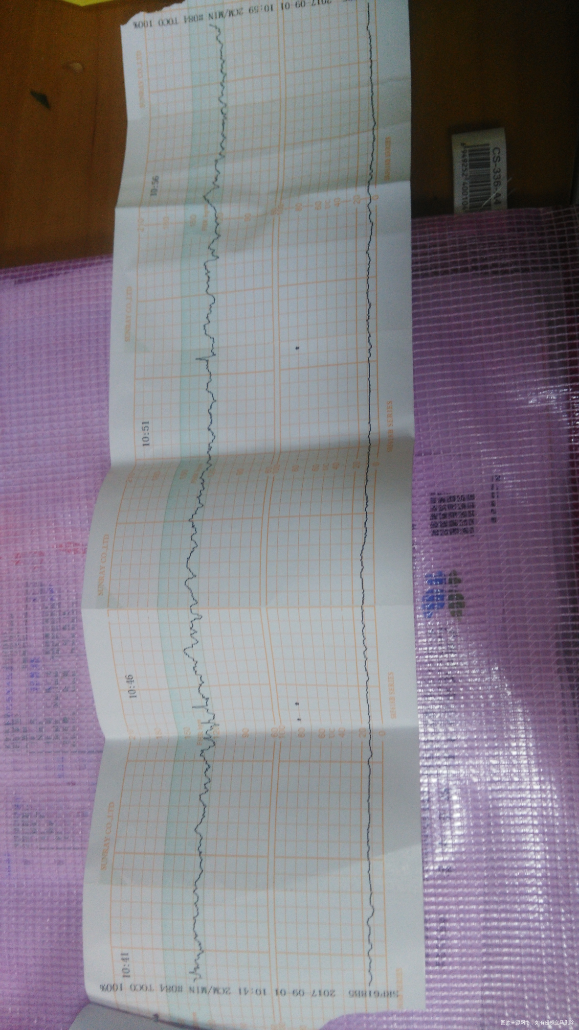 医生,我这个胎监很差吗,医生让重新做