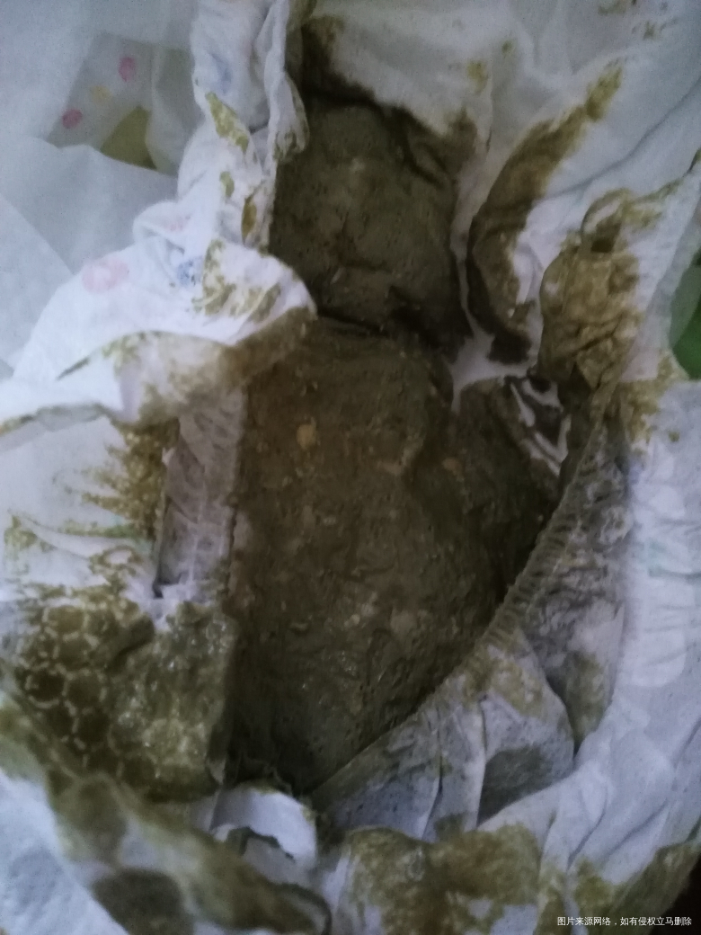 医生,小孩连续好多天都拉这么绿的屎,这是啥问题?