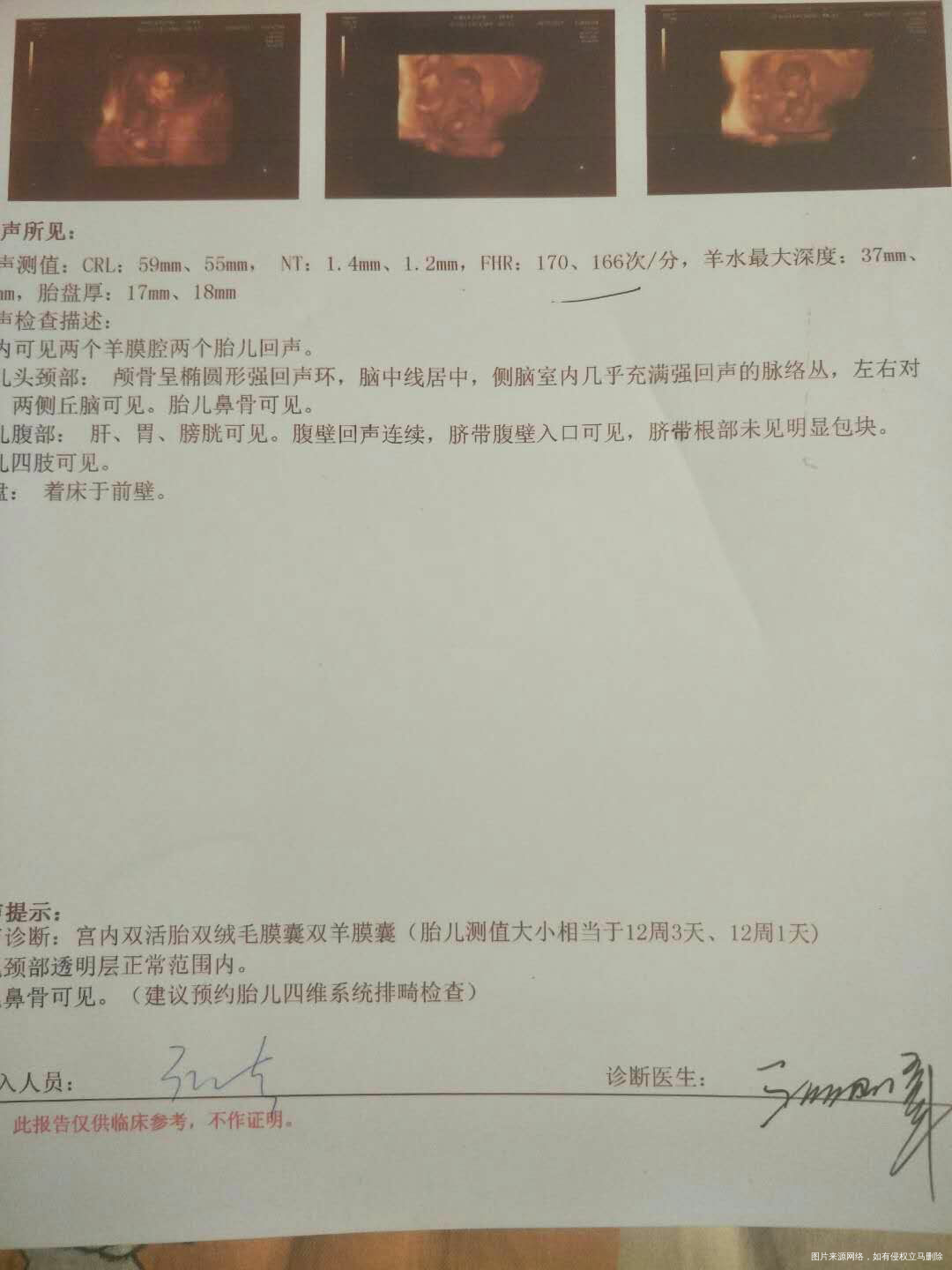 【扒一扒我曾经做过的四维检查】+我的龙凤宝宝们!