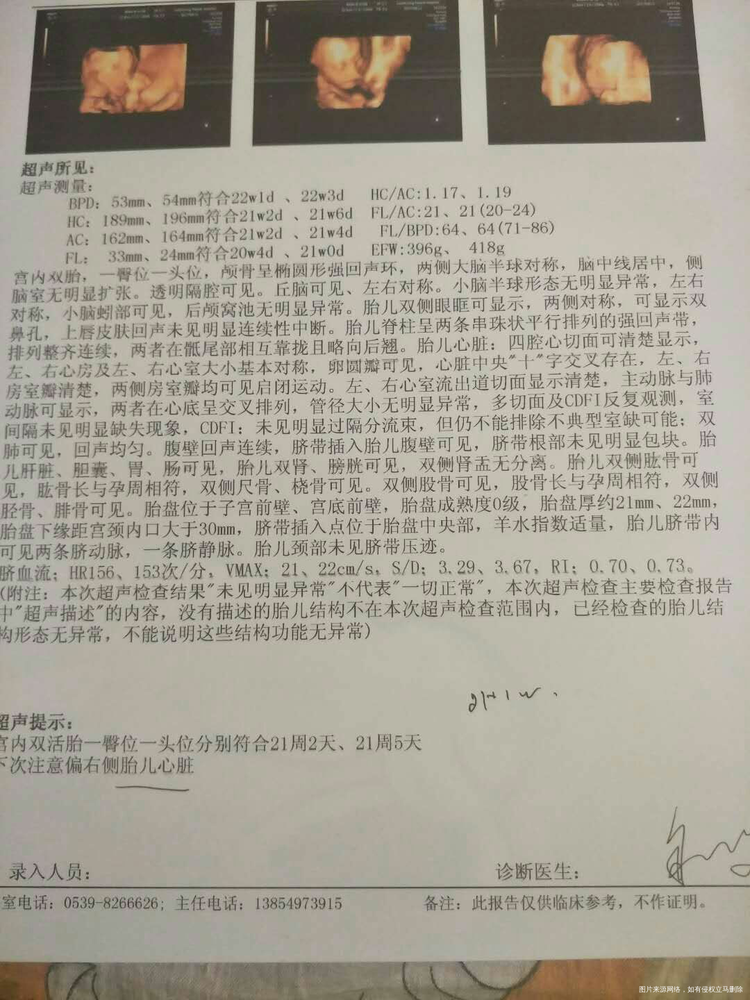 【扒一扒我曾经做过的四维检查】+我的龙凤宝宝们!