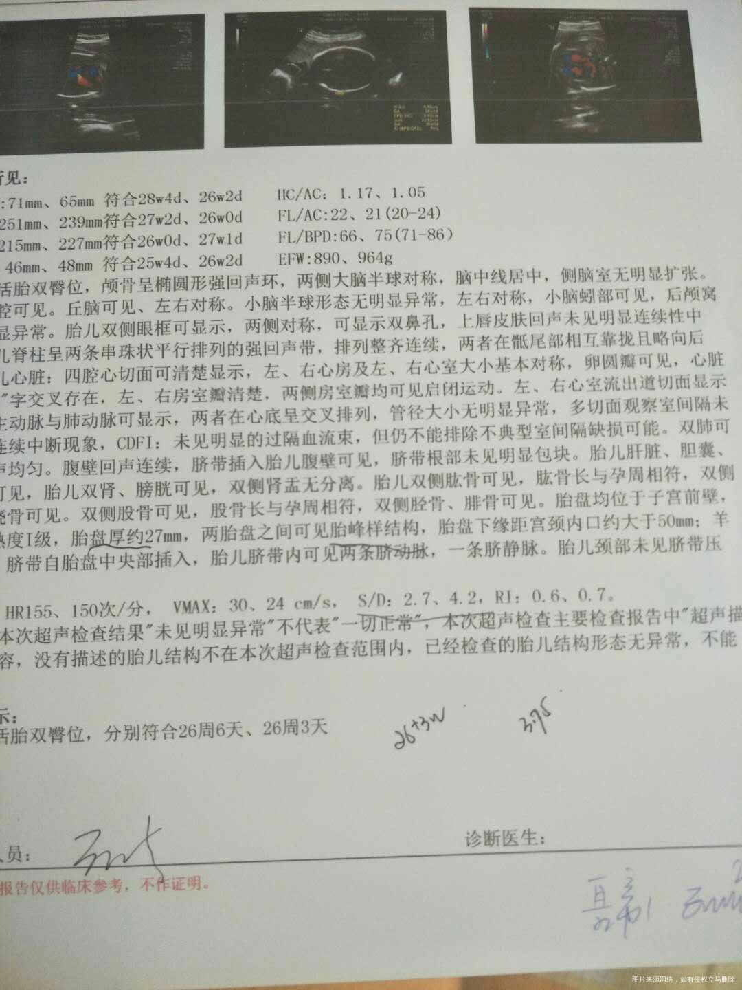 【扒一扒我曾经做过的四维检查】+我的龙凤宝宝们!