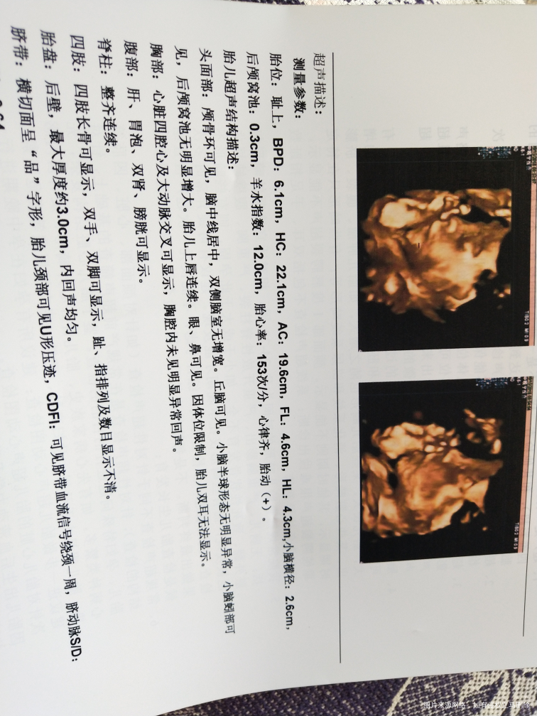 四维彩超上的数据怎么看?