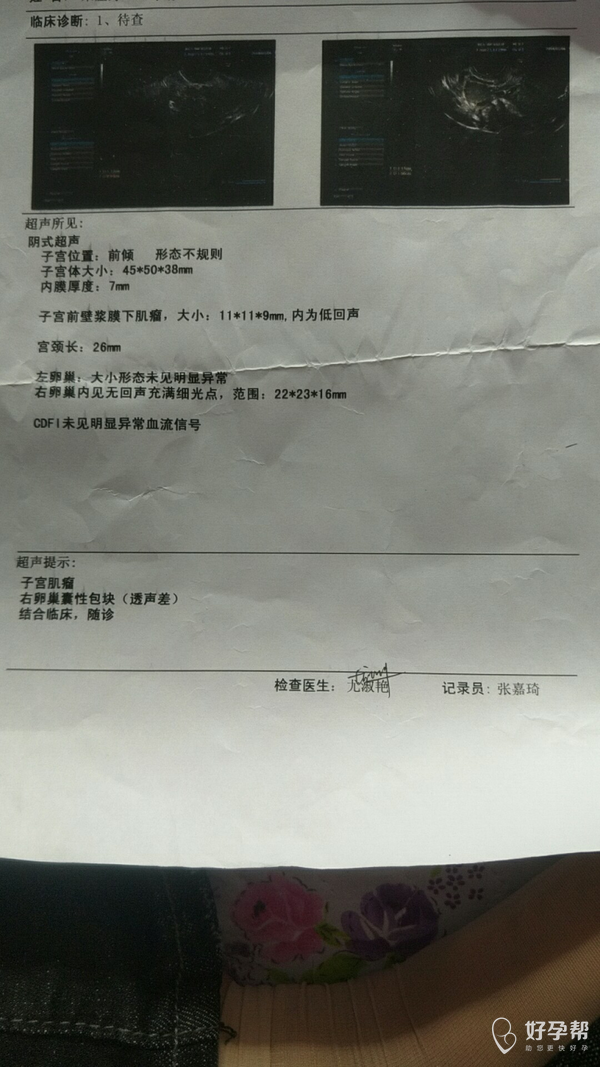 有什么治愈的方法-输卵管通而不畅-伞端粘连-输卵管积水-难孕治疗论坛