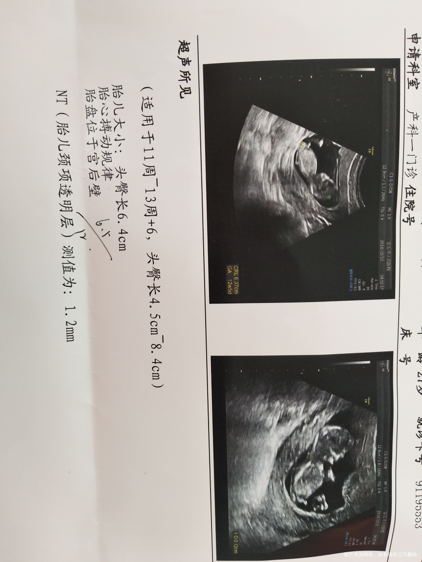 有会通过nt单子看男女的姐妹吗?帮我看一下