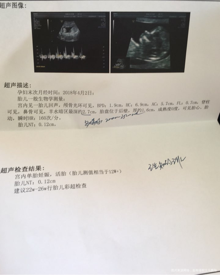 我想问下我这个Nt结果正常吗?