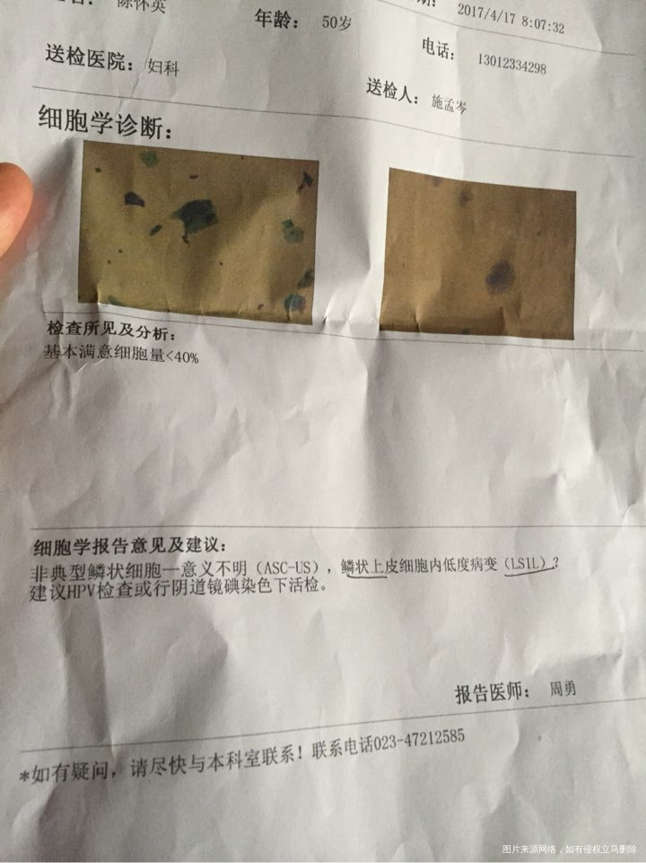 麻烦帮忙看一下结果,是什么意思