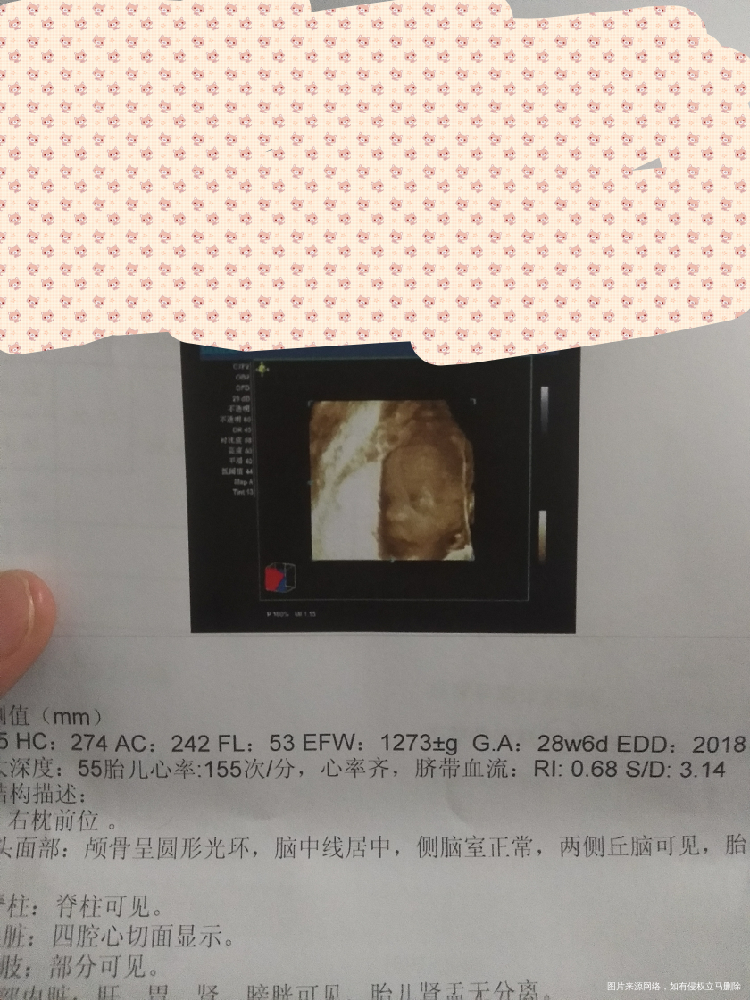 各位姐妹们帮忙看看像男宝多点还是女宝多点