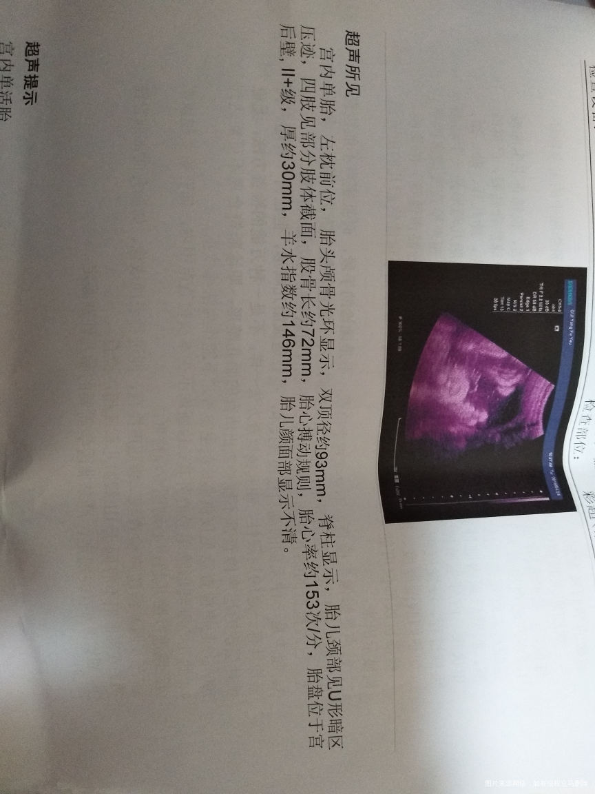 麻烦医生帮忙看看检查结果