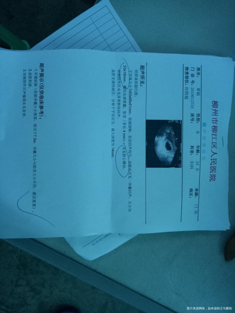 医生们帮看看,为什么上次有胎心博动这次检查没有了呢