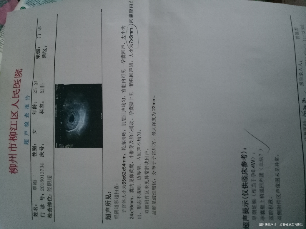 医生再帮我看看,孕酮从52降到34