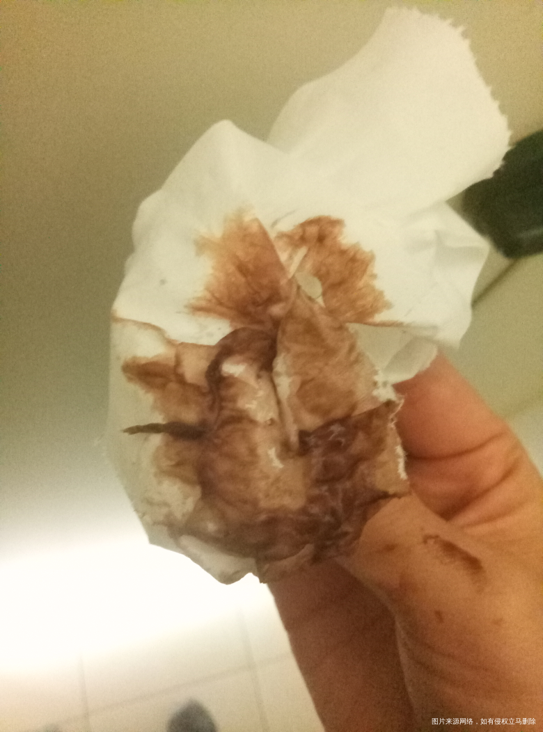 孕24周,忽然流血,请帮助我