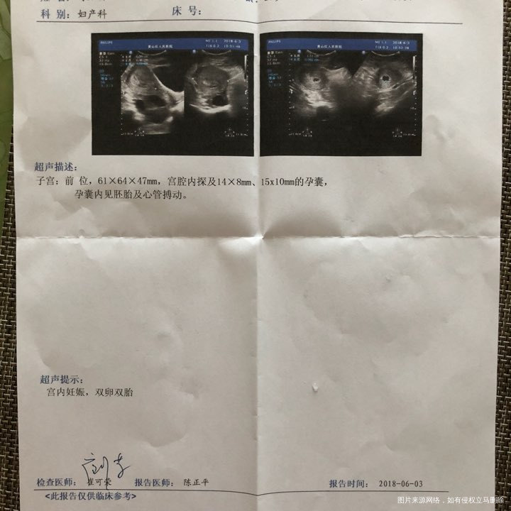 孕囊大小正常吗?移植26天