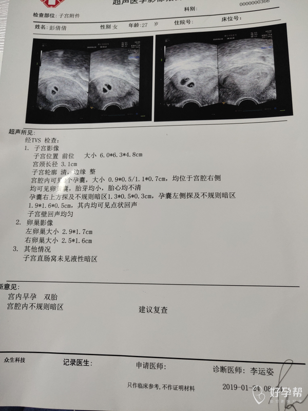 今天下午肚脐下偏左有疼痛![/stora