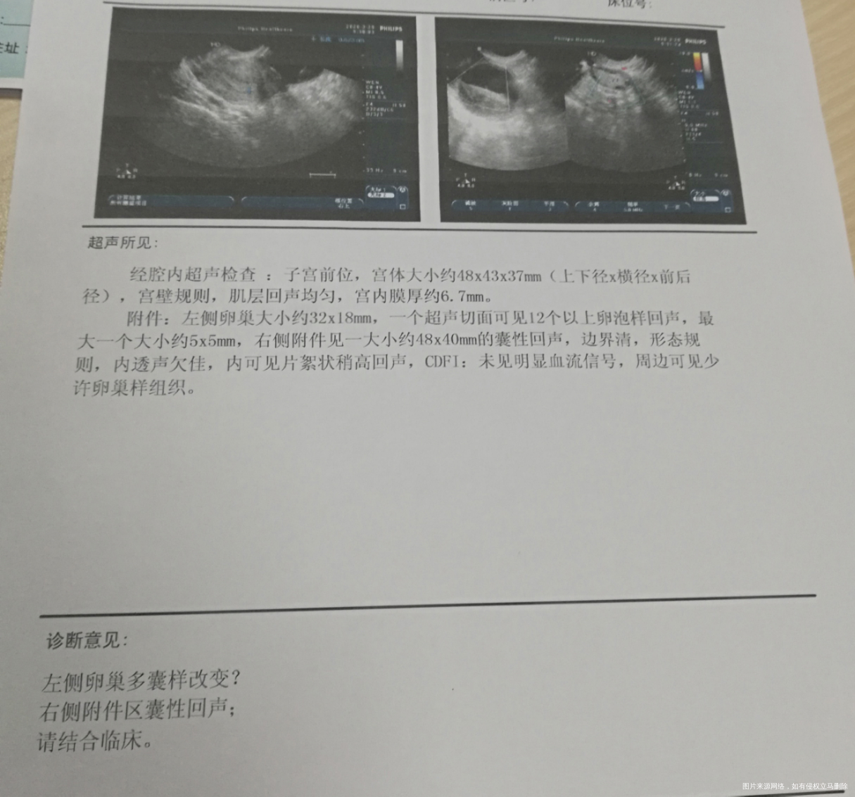 求助医生帮忙看下,我这个囊肿怎么回事?需要动手术吗?