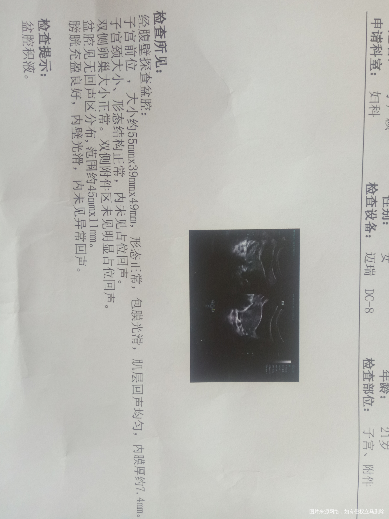 有医生帮我看看这个B超单么