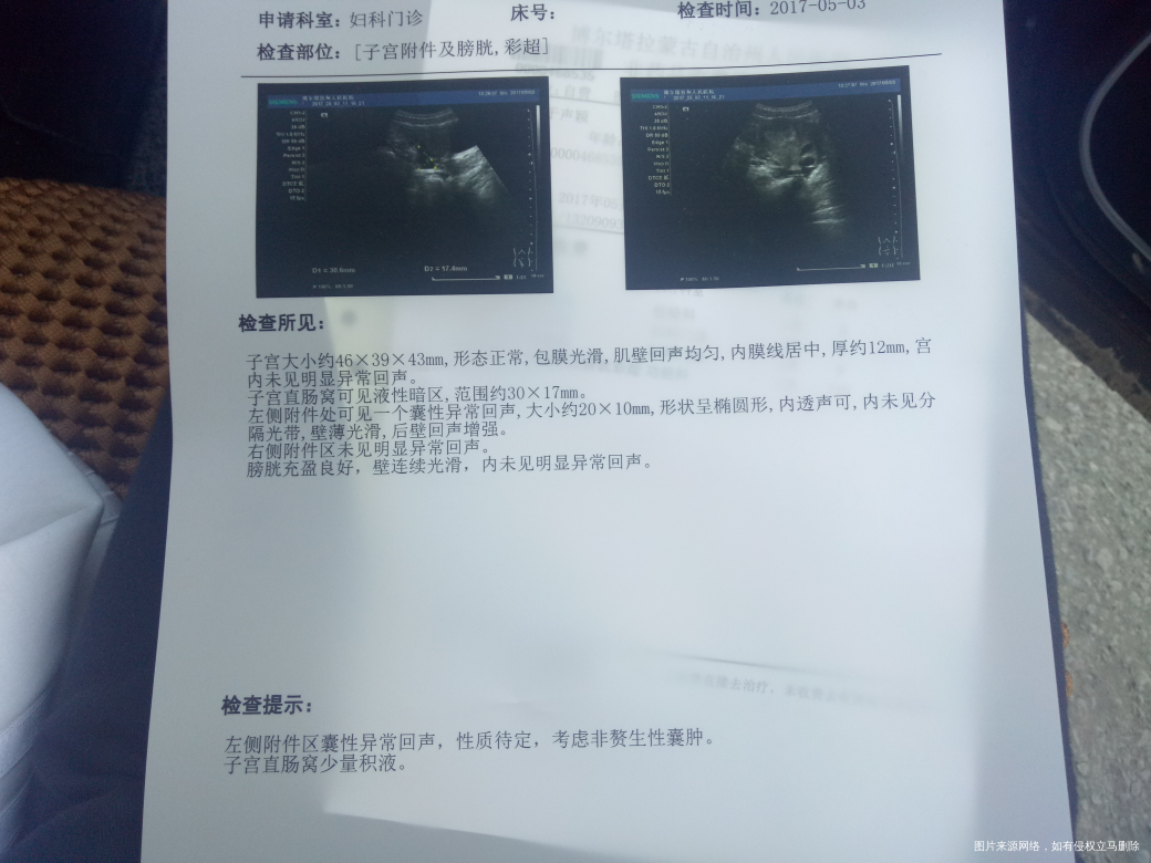 请医生帮我看下这个b超单