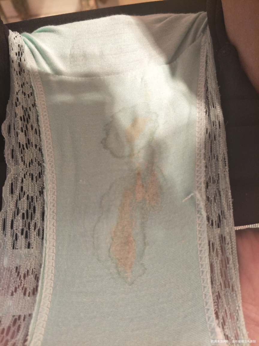 内裤分泌物图,医生可以帮我看看是怎么回事么