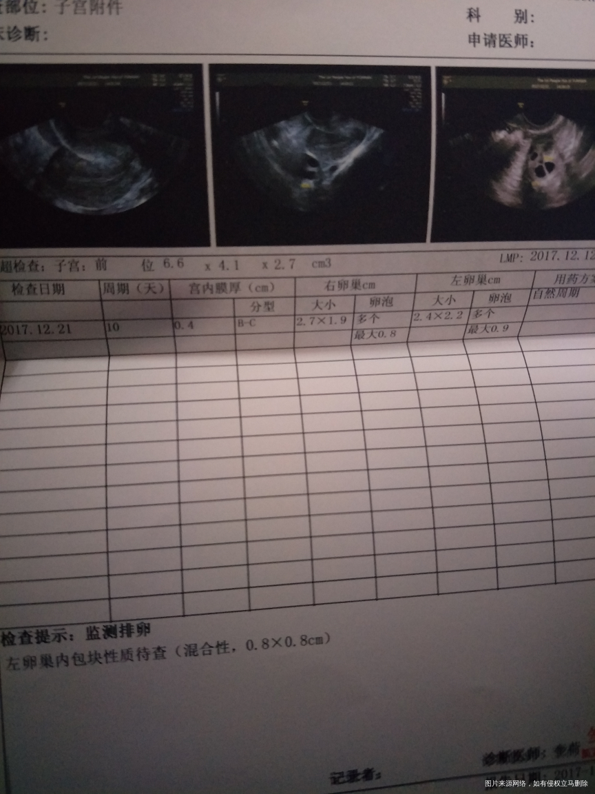 别让我的希望破灭,是喜是忧?