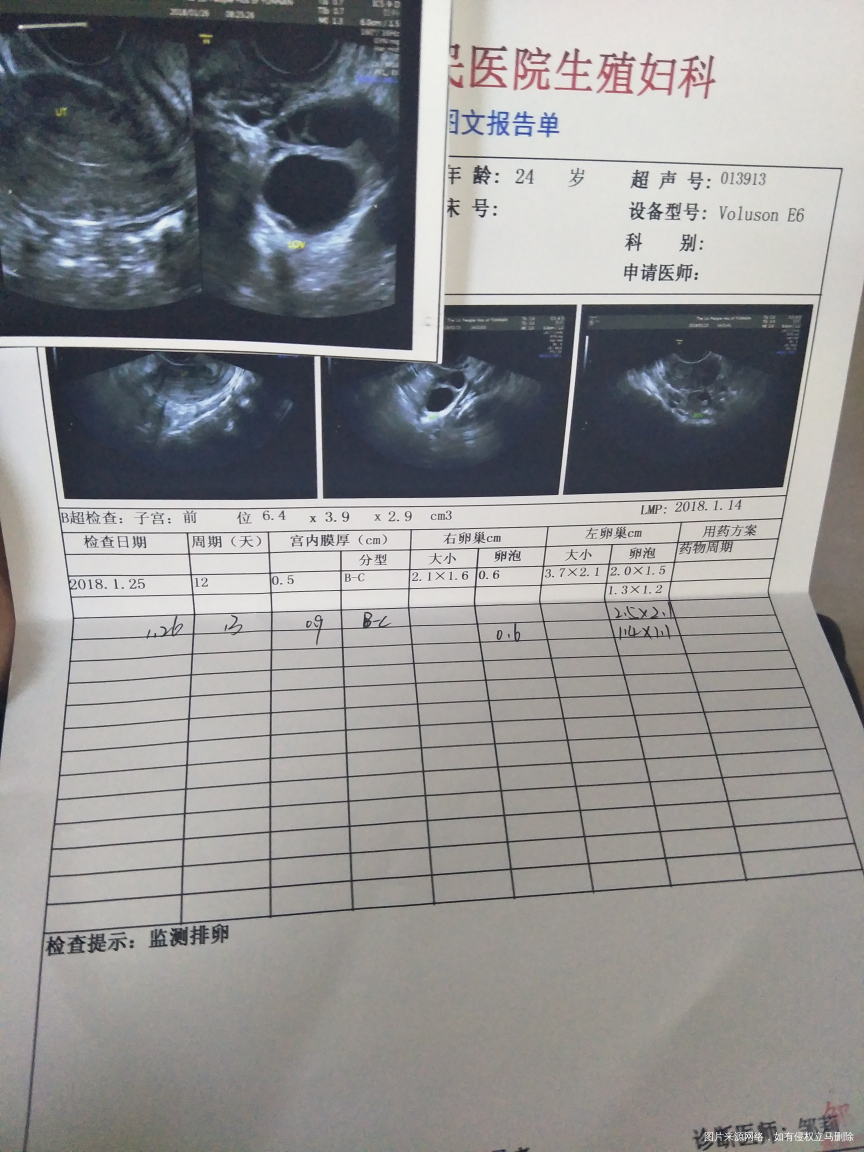 医生帮忙看看是不是排了