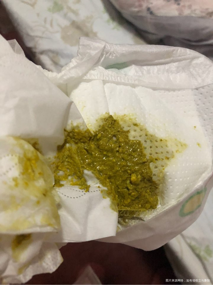 刚出生的宝宝拉这样的便便