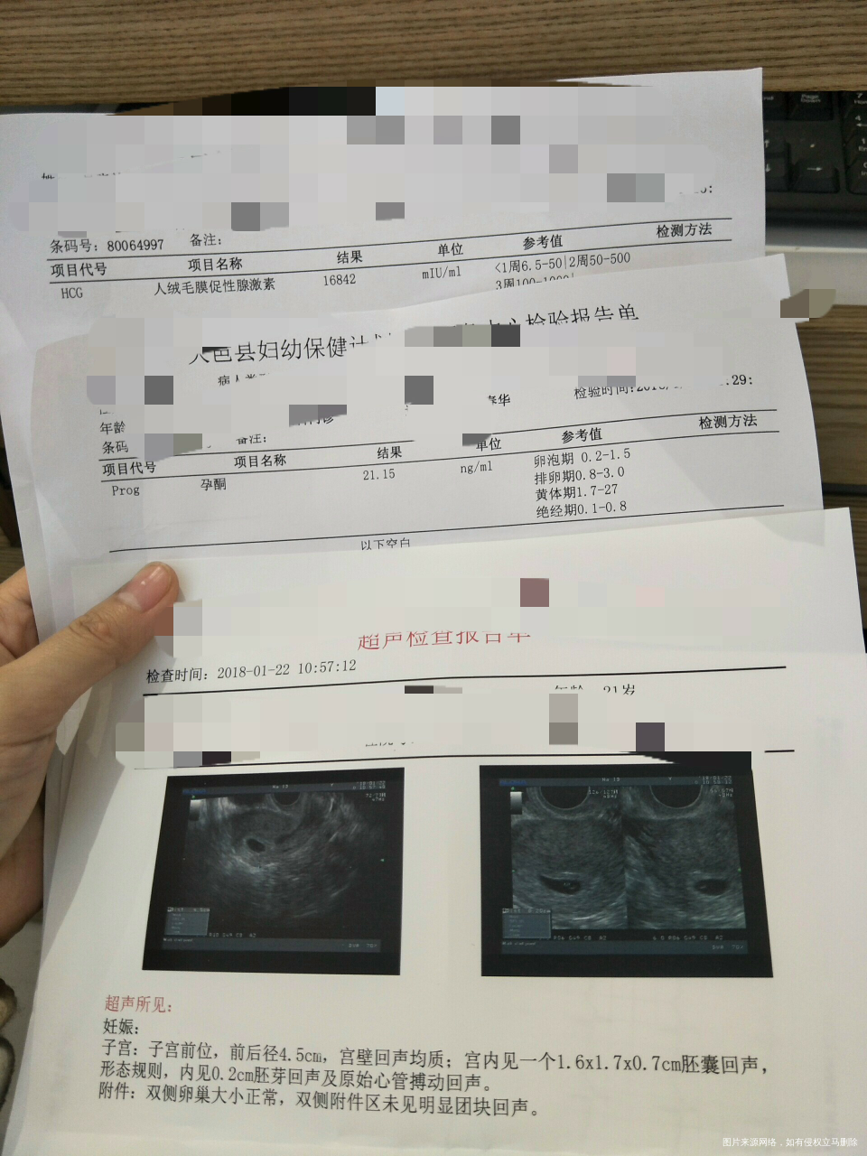 医生帮我看看,有没有事?